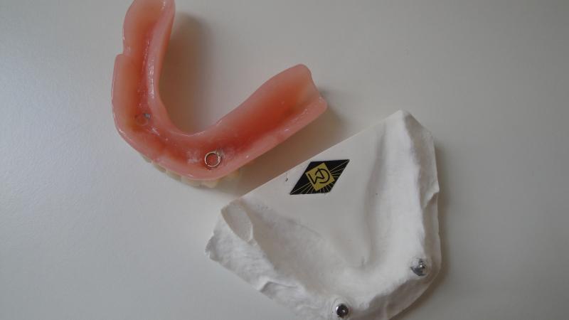 Implantatprotese